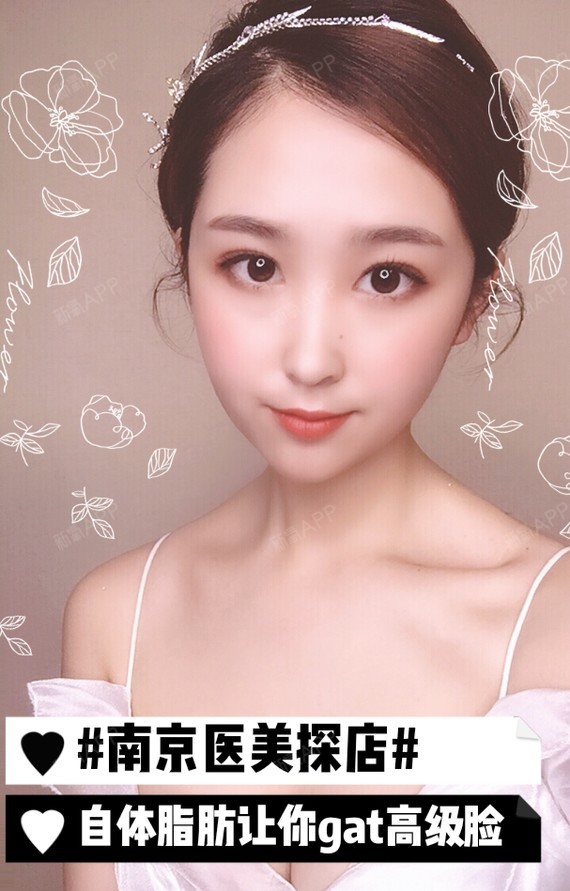 南京医美探店|自体脂肪让你Gat高级脸!出门在