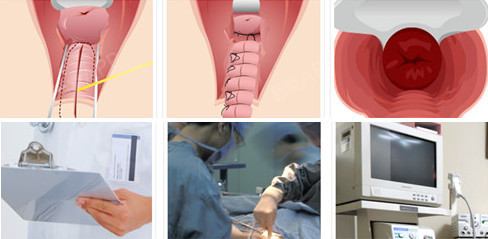 阴道紧_圈子-新氧美容整形