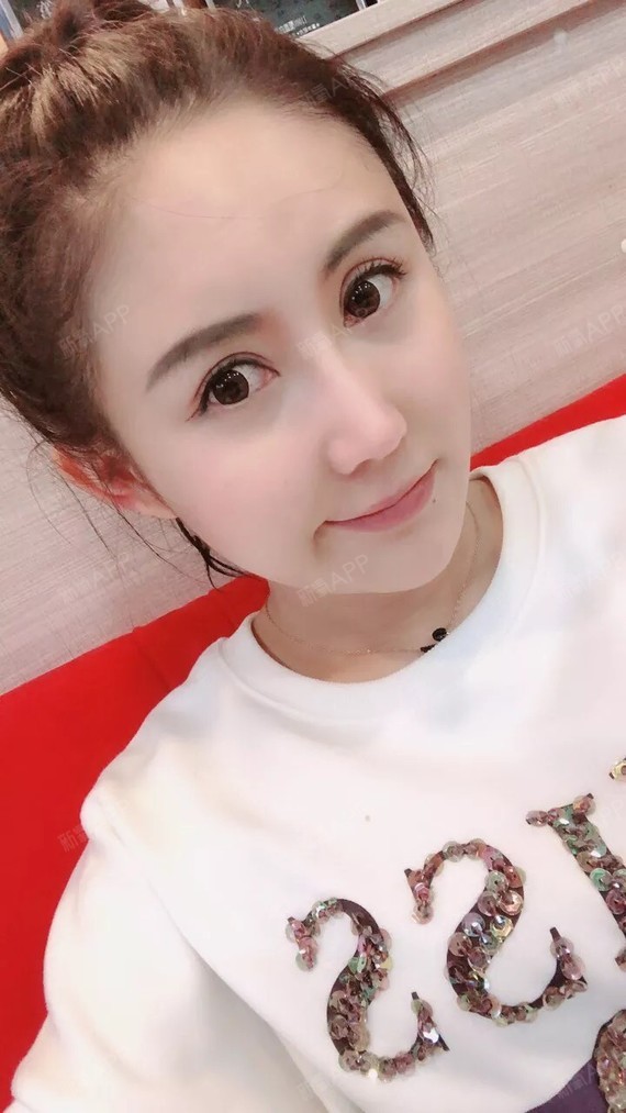 为什么我要经常去温州和平整形医院定期打水光