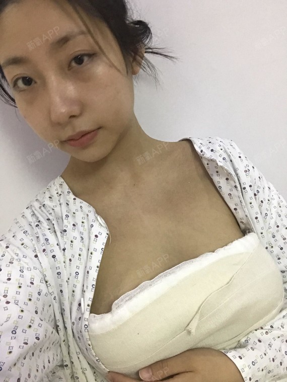 有胸才是完美女人~所以坚决也是要做个完美女人,我想_圈子-新氧美容