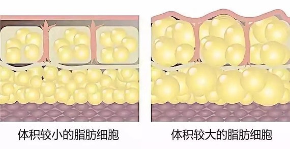 吸出的脂肪就沒用了嗎?