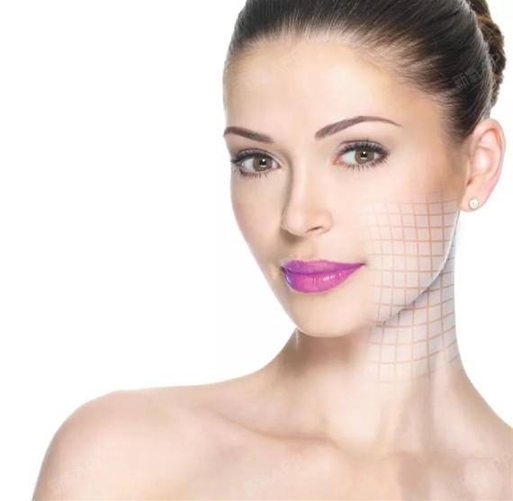 全脸线雕安全吗怎么才能规避它的风险呢