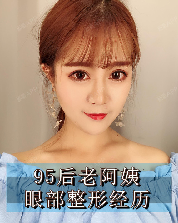 南京医美探店|95后老阿姨眼部整形经历◇体验