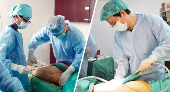 有什么后遗症吗?可怕!抽脂前须知!