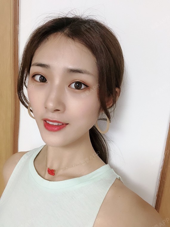 现在我的鼻子小巧笔直,端庄秀气,闺蜜说我是玲珑巴掌_圈子-新氧美容