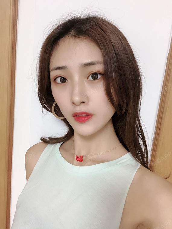 现在我的鼻子小巧笔直,端庄秀气,闺蜜说我是玲珑巴掌_圈子-新氧美容