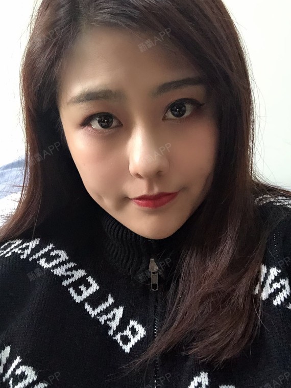为什么有的人线雕后脸变形、线不吸收?线雕可
