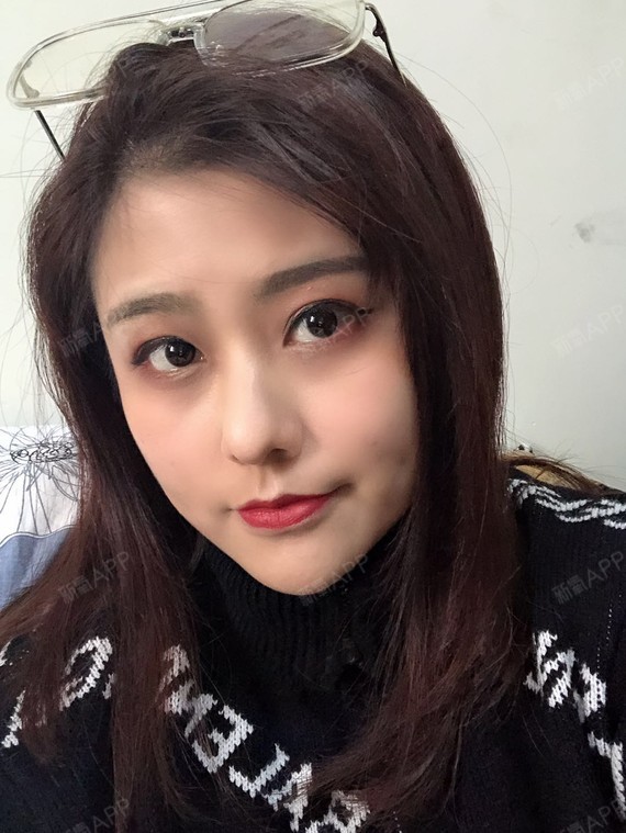 为什么有的人线雕后脸变形、线不吸收?线雕可
