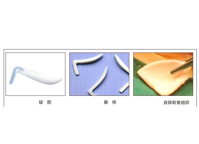 l型两种; 2膨体假体;聚四氟乙烯