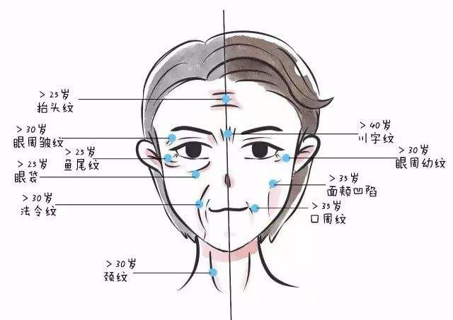 打完肉毒素去除木偶纹后会肿胀或青紫吗大概几天能基本恢复