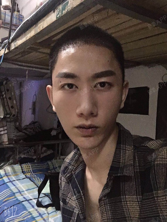 植完发的人(植完发的头发是不是长的慢)