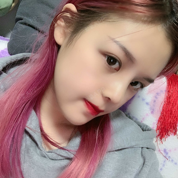 重庆膨体隆鼻好不好_效果图_欣宝贝儿膨体隆鼻术后第29天_新氧美容