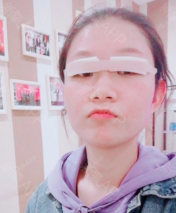 很多问题,医生一点也没有不耐烦,还把我眼睛存在的问题都分析出来了