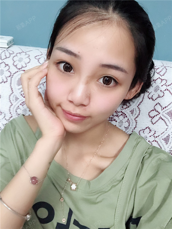 朋友_圈子-新氧美容整形