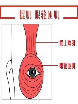上睑提肌手术是什么