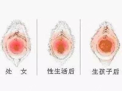 可以说处女膜这两种作用都有占到.