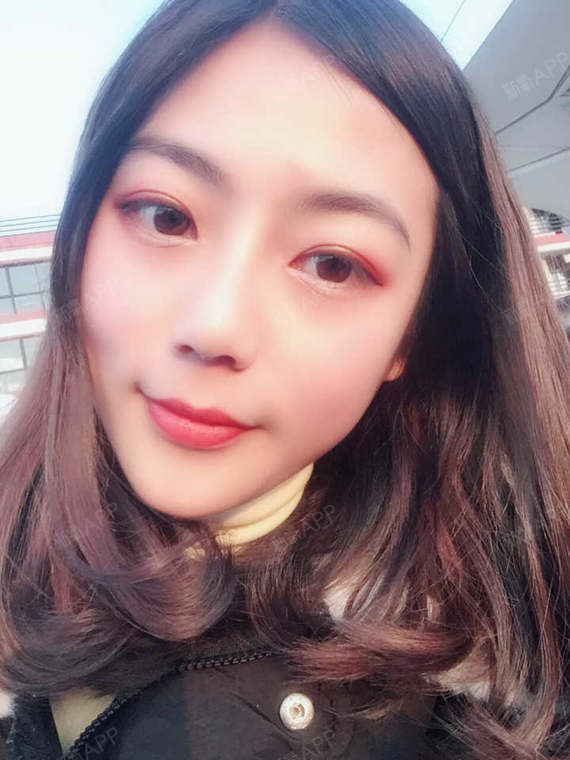 打了过了半个月了,脸上没那种紧绷绷的感觉了,水润润_圈子-新氧美容