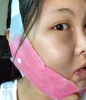拍照时根本无角度可抓,真是怎么拍怎么大, 我的情况主要是颧骨高而且