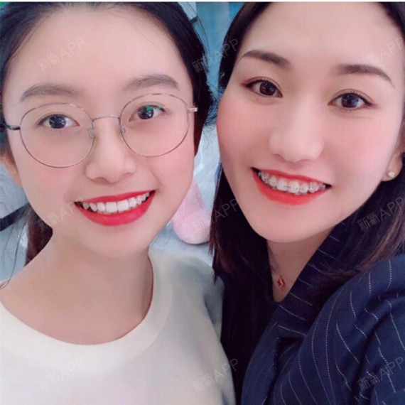 什么是牙齿冷光美白?#你是"糯米齿"吗?