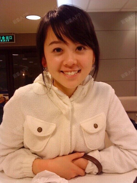 烤瓷牙贴面真正适合牙齿向内倒的人(比如某幂
