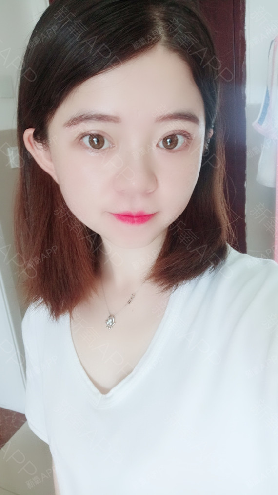 我觉得我做完双眼皮之后眼睛变成了圆的大家都说挺可爱的双眼皮恢复的