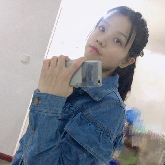 牙齿稀疏矫正牙缝大钢丝牙套正畸#广州_圈子