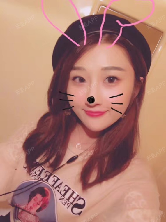 玻尿酸隆鼻能维持多久时间?玻尿酸塑型能力的