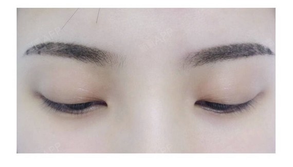 眉毛终于恢复好啦,我算是恢复很快的啦,今天才第四天呢,就好了.