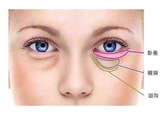 向下的部分有一个凸起,这个凸起就是我们通常说的:笑台或眼台或卧蚕