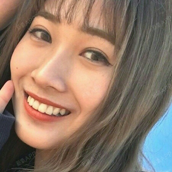 75笑露牙龈,驴子绰号难摆脱笑容是与别人拉近距离的