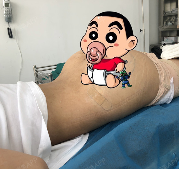 第10天