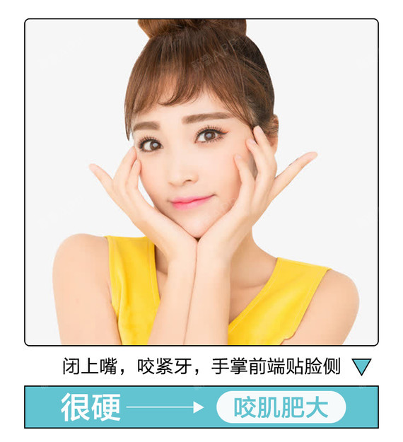 【除皱瘦脸】衡力 除皱瘦脸 100单位 ,俏脸针,【国产衡力/进口保妥适