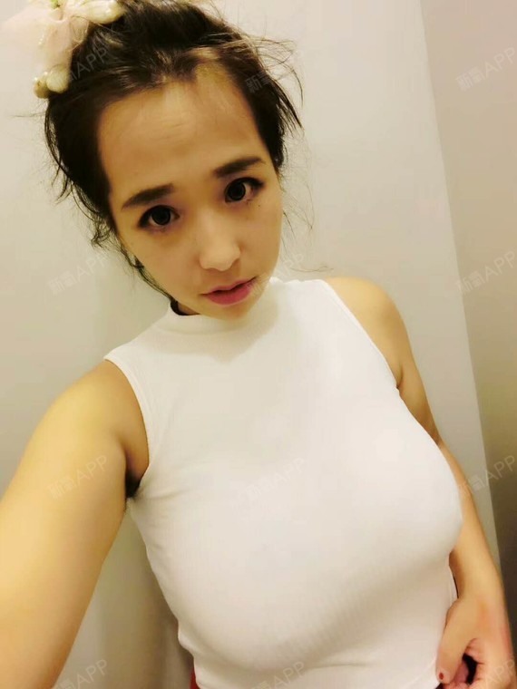 假体隆胸是在胸部周围做一个切口,然后把雕塑好的乳