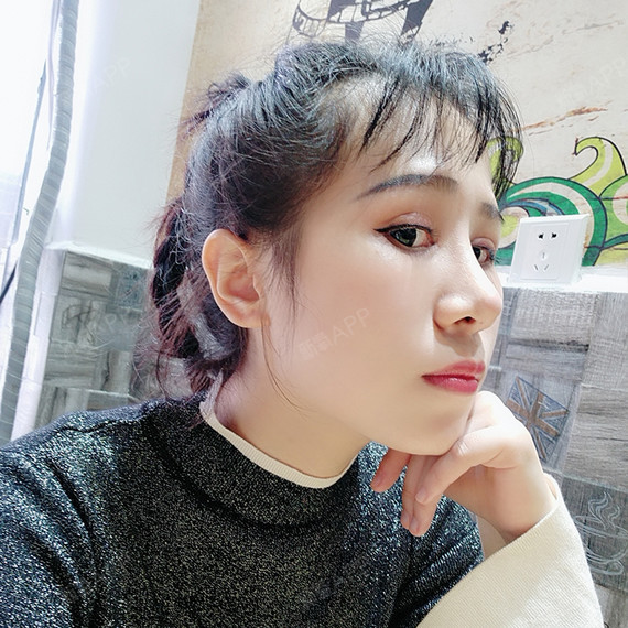 隆鼻取出假体后要注意什么1遵照医嘱服用抗生