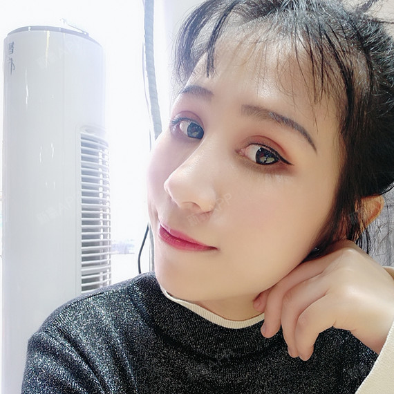 隆鼻取出假体后要注意什么1遵照医嘱服用抗生