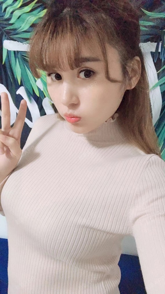 之前我是a罩杯,做的是假体隆胸.