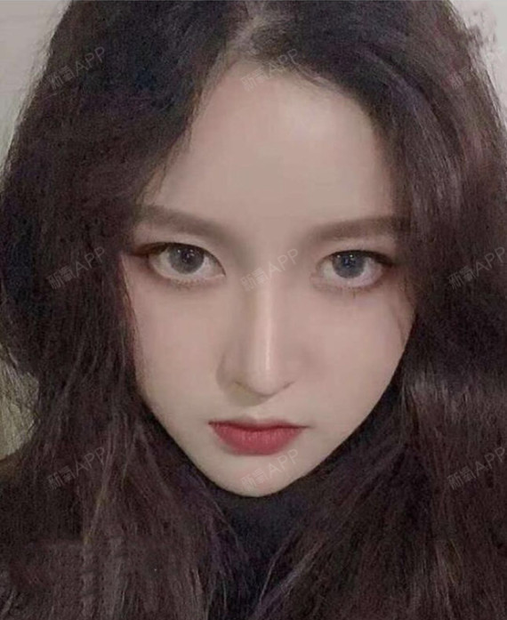 鼻子高度起来了面部也瘦下来了,感觉就是好整个五官就_圈子-新氧美容