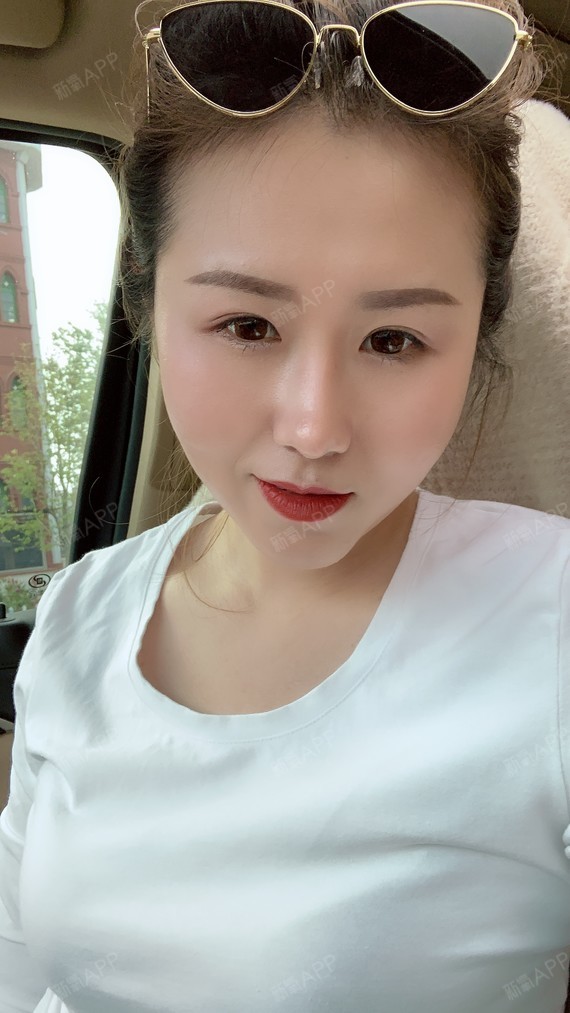 硅胶隆鼻好不好_效果图_养猫派兔发发硅胶隆