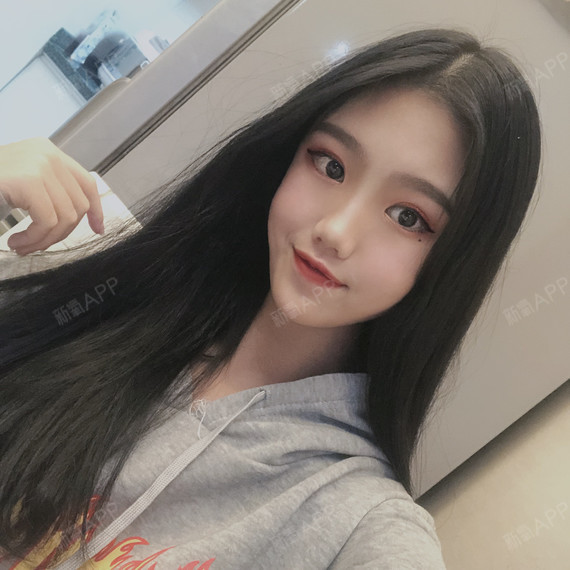 在我的影响和安利下,我有2个单眼皮的朋友也去割双眼_圈子-新氧美容