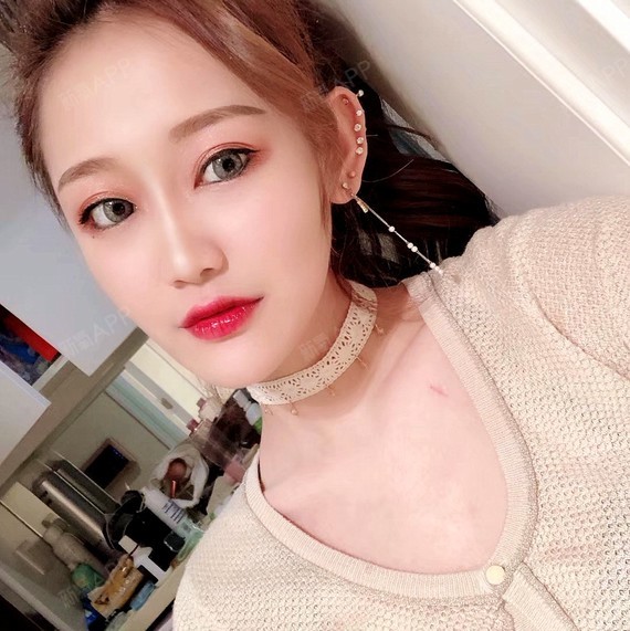 正面照可能看不出鼻子真实的高度,封面就祭出我高耸立_圈子-新氧美容