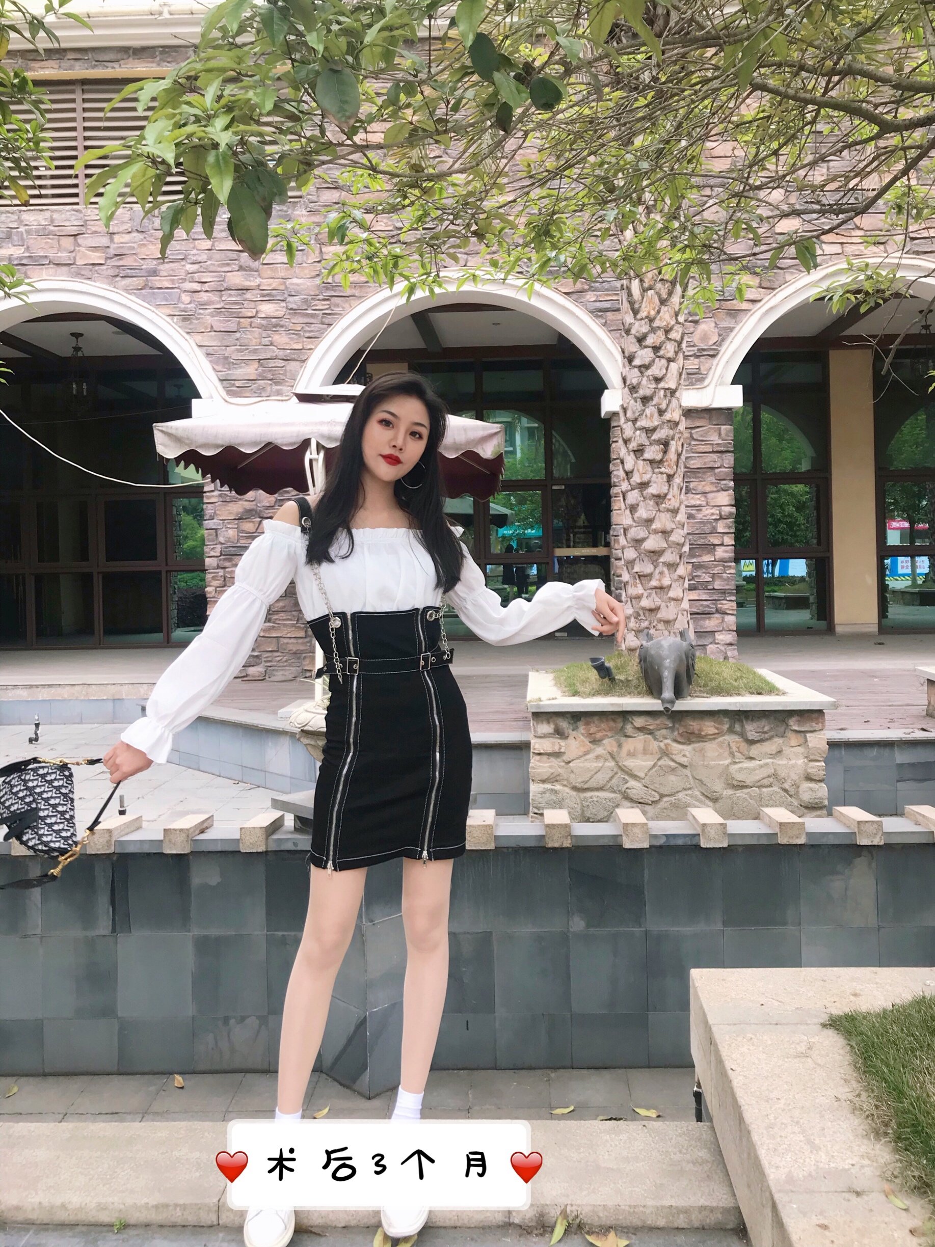 "大象腿"如何秒变细长直?减肥是女孩子永恒的话题,_圈子-新氧美容整形