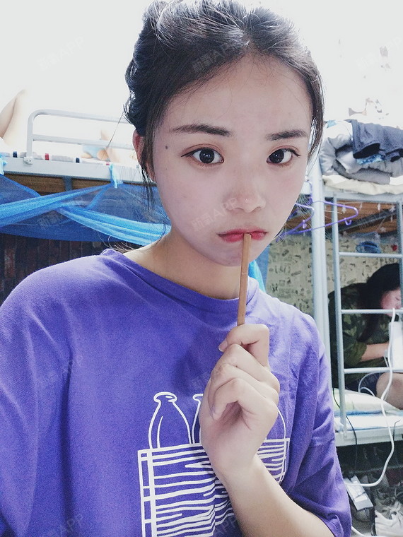 成都果酸焕肤好不好_效果图_大眼萌儿果酸焕肤术后第30天_新氧美容