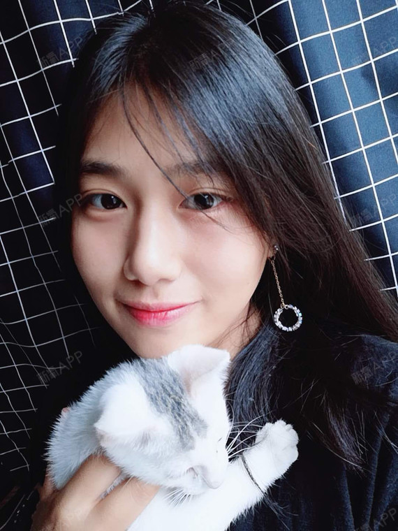 激光祛斑好不好_效果图_娜就是我lg激光祛斑术