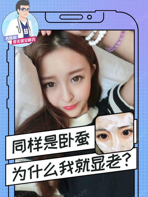 同样是卧蚕,为什么我就显老?人未老,眼先老.眼