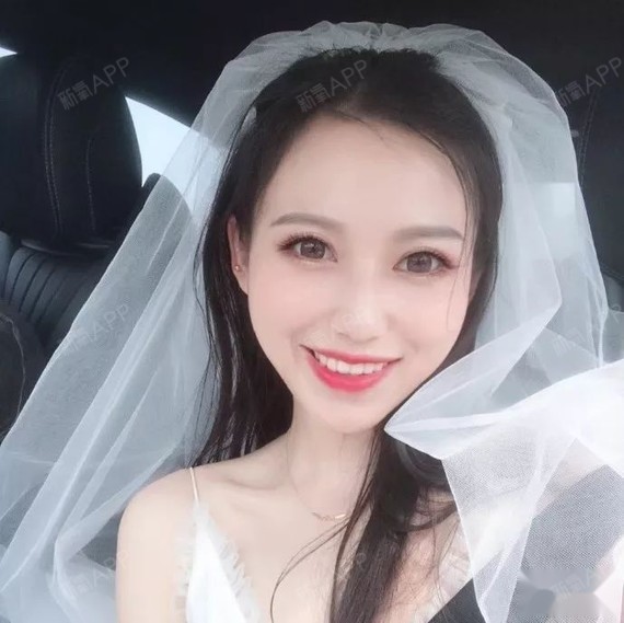 戴牙套的女生,是草莓味儿的(贝致牙套女神第二弹)