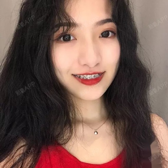 戴牙套的女生,是草莓味儿的(贝致牙套女神第二弹)