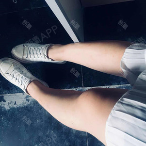 其实我身上其他地方还好,就是腿上的毛毛特别多,有点_圈子-新氧美容