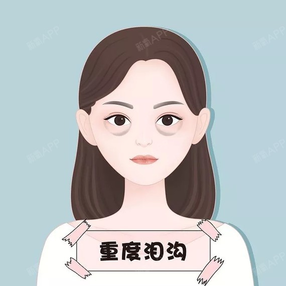 是天生的吗?能消除吗?之前为大家说到眼袋,这