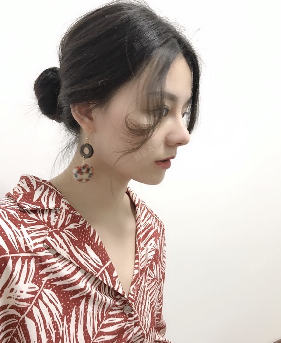 膨体隆鼻好不好_效果图_氧气zz1m0膨体隆鼻术后第94天_新氧美容整形