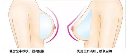 本人特别瘦 能做假体隆胸吗 效果好不 新氧美容整形